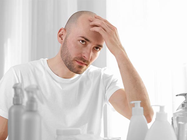 Male Hair Loss Solution by Alex Milligan
