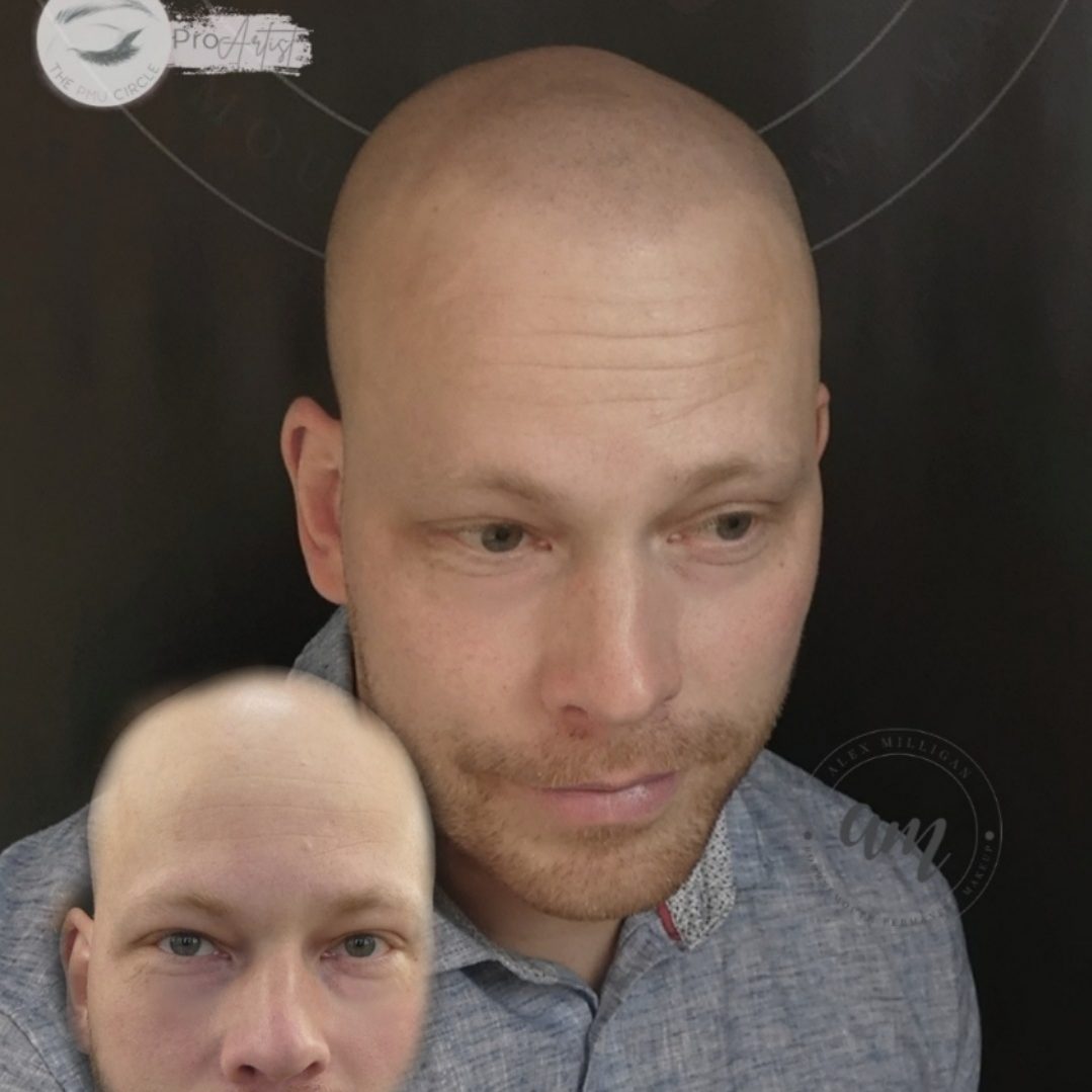 smp before and after