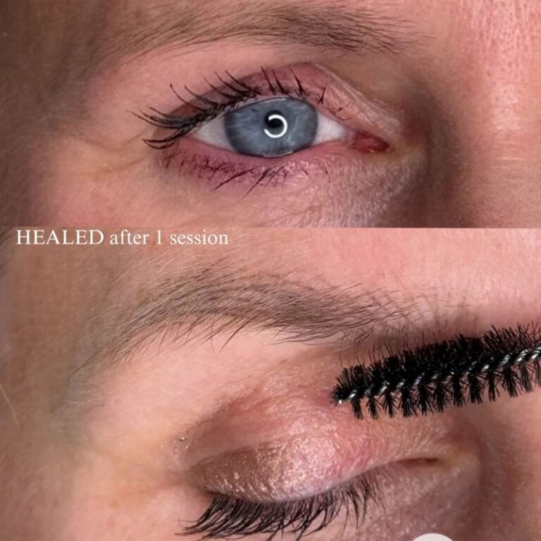 Healed Hyperrealism Brow – 6 weeks after first session