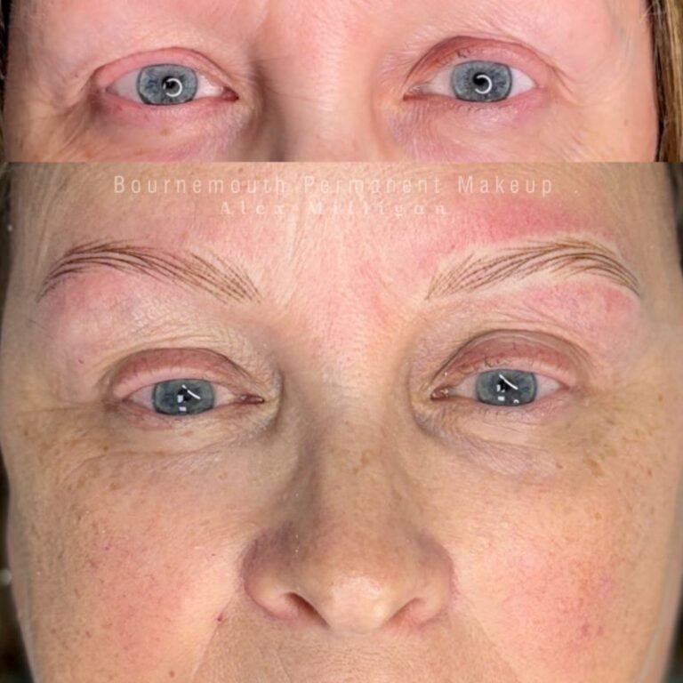 Hyperrealism Brows for Alopecia Client